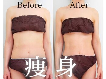 ユニクリア(Uni clear)/佐賀市ユニクリア痩身エステ