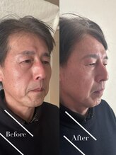 ウィンサムテン 新宿店(Winsome)/メンズ眉毛＋ぐっすりヘッドスパ