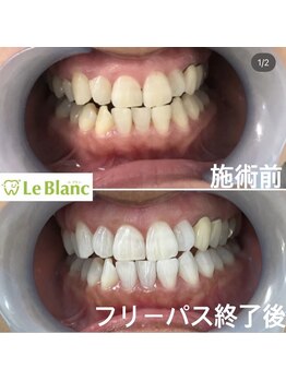 ルブラン 奈良店(Le Blanc)/清潔感のある歯に！