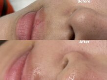 アイロンボーイ(IRONBOY)/艶肌お顔全体WAX