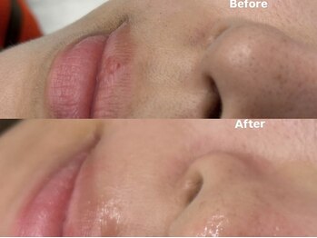 アイロンボーイ(IRONBOY)/艶肌お顔全体WAX