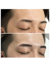 ホワイト(WHITE)/□Before→After