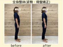 ヴィーネス(VIENESS)/【全身整体/姿勢・骨盤矯正】