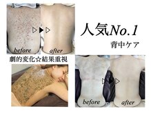 スキンプローズ(skinprose)の雰囲気(結果出し重視★背中ケアが人気No.1★肌トラブルのお悩みを解決)