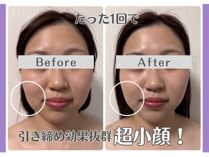 ルリアン(Lurian)の写真