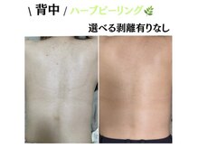 モンクラッシー(Mon classy)の雰囲気（背中ニキビ、跡も魅せる背中へ）