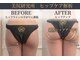 美尻研究所 銀座店の写真
