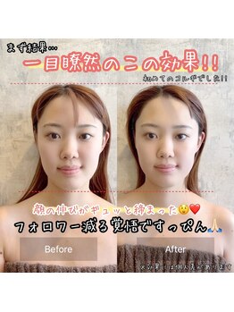 フフラ KANコルギセラピー山梨本店(fufla)/人気No. 1メニュー【コルギ】