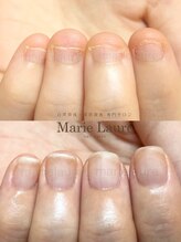 マリーロール 淀屋橋本店(Marie Laure)/自爪育成/深爪矯正/ネイルケア