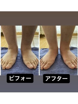 ヒヨリ(hiyori)/ゴットクリーナー