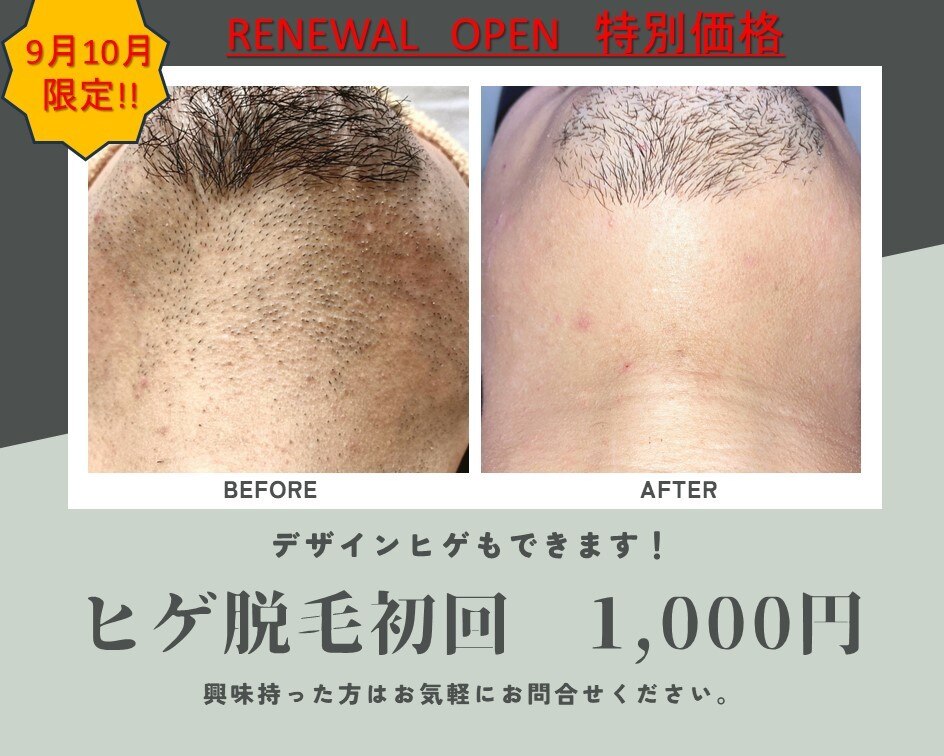 NONOヘアー お値下げ中 3442-6332-