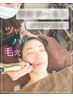 【リジュラン同等】無針サーモン(PDRN)導入!! 13200→5990円