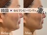 感動フェイシャル「韓国式肌管理」セルマン艶玉肌ピーリング　憧れの陶器肌に