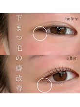 エトワボーテ(Et toi beaute)/上下ラッシュリフト