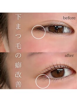 エトワボーテ(Et toi beaute)/上下ラッシュリフト