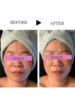 ワン ストレッチ(ONE stretch)/【小顔になります】