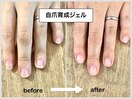 自爪育成ジェル　before→ after