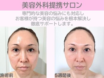 ぷるるんエステ/バストケア/痩身/フェイシャル