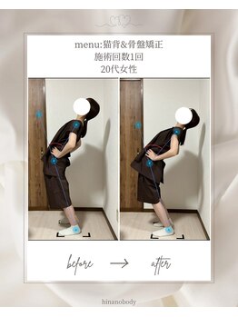 ヒナノボディ(HINANO BODY)/お客様ビフォーアフター