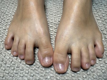 バレ(BARE)/フットケア