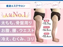 フォーレディ 池袋店の雰囲気（初回のカウンセリングには少々お時間が必要になります☆痩身）