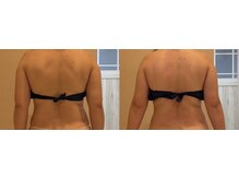 ルーチェ(Luce)/【チノザメソッド】美骨BODY