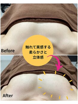 アール(R)の写真/バストでお悩みの方必見！オールハンドマッサージによるバストケア。