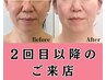 【シワたるみ改善スペシャル】小顔美容整体×たるみシワ改善マシン5種80分