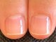 ネイルサロン ベルエトワール(belle etoile)の写真/深爪・ちび爪・平爪・噛み爪などでお悩みの方やむしり癖のある方必見！コンプレックス爪を美爪へ導きます♪