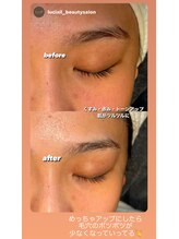 ルシアル(LUCIALL)/