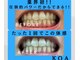コア(Koa)の写真