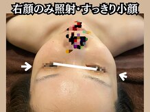 小顔屋の雰囲気（小顔専門店・エイジングケアに特化したサロンです。）