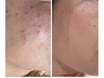 エステサロン オパール(OPALE)