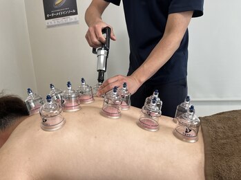 上楽スポーツ鍼灸院/オプションメニューも豊富