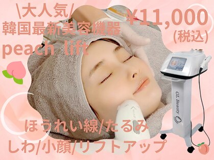 シャンス(Chance)の写真