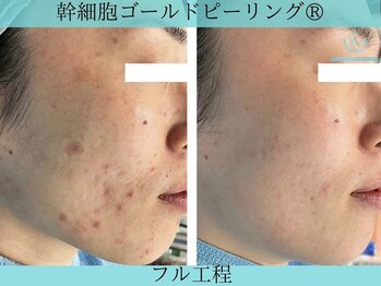 リメイククリニカルビューティー(Remake clinical beauty)/