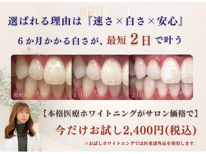 ブリエ(BRILLER)の写真