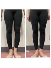 いわき美容整体院/O脚矯正