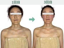 ドクタープラント 北心斎橋店(DR PLANT)/顔の軸・巡り・印象美アップ！