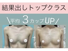 サラエクセレント 天王寺(SARA EXCELLENT)の雰囲気（カウンセリングからバストアップニストにお任せ♪元祖脂肪増殖店）