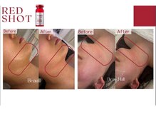 アメリイ 百合ヶ丘 新百合ヶ丘(Amerii)/フェイスラインのたるみ、ハリ