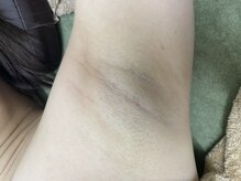 ナノハナ/鹿沼市全身脱毛美容室ナノハナ