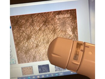 サロンこみち/マイクロスコープ診断できます!