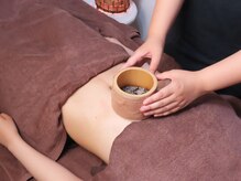 瀬戸の杜鍼灸治療院 アンド ピュアボディ(Pure body)/へそ灸で腸内温度に効果◎