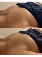 ミリミリ(mili mili)/before→after