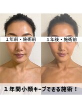 お顔の研究所/ビフォーアフター写真♪