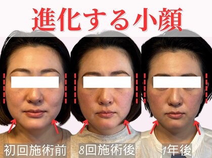 フレキシボディ(FlexiBody)の写真