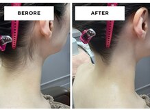 ポンテ ダイマル(Ponte DAIMARU)/ブライダルシェービング