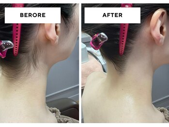 ポンテ ダイマル(Ponte DAIMARU)/ブライダルシェービング