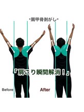【医療提携】首肩こり・腰痛整体・マシンピラティスASABA整体院/新松戸店/肩甲骨から筋膜リリース結果写真